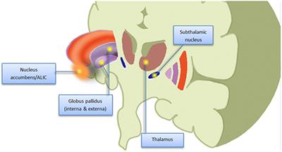 Proceedings of the Fourth Annual Deep Brain Stimulation Think Tank: A Review of Emerging Issues and Technologies